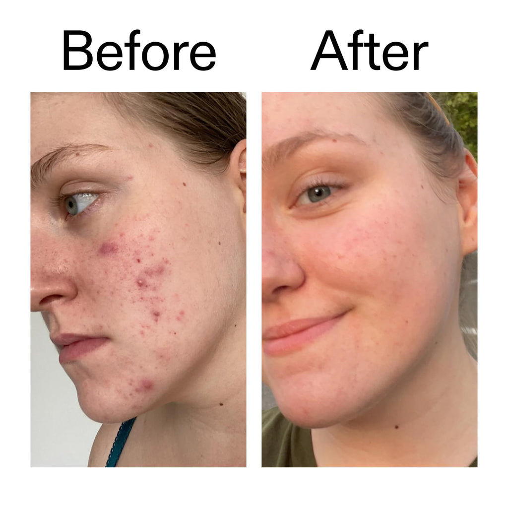 The INKEY List 15% Vitamin C and EGF Serum Helps to Intensively Brighten All Skin Types 30ml - Damaged Box