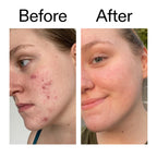 The INKEY List 15% Vitamin C and EGF Serum Helps to Intensively Brighten All Skin Types 30ml - Damaged Box