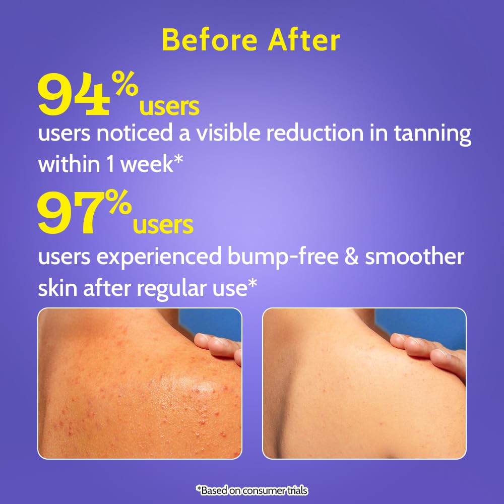 Chemist at Play Body Wash Exfoliating for Dry Rough Bumpy Strawberry Skin with 1% Salicylic Acid 2% Lactic Acid and Ceramides for Men and Women | 236 ml - New
