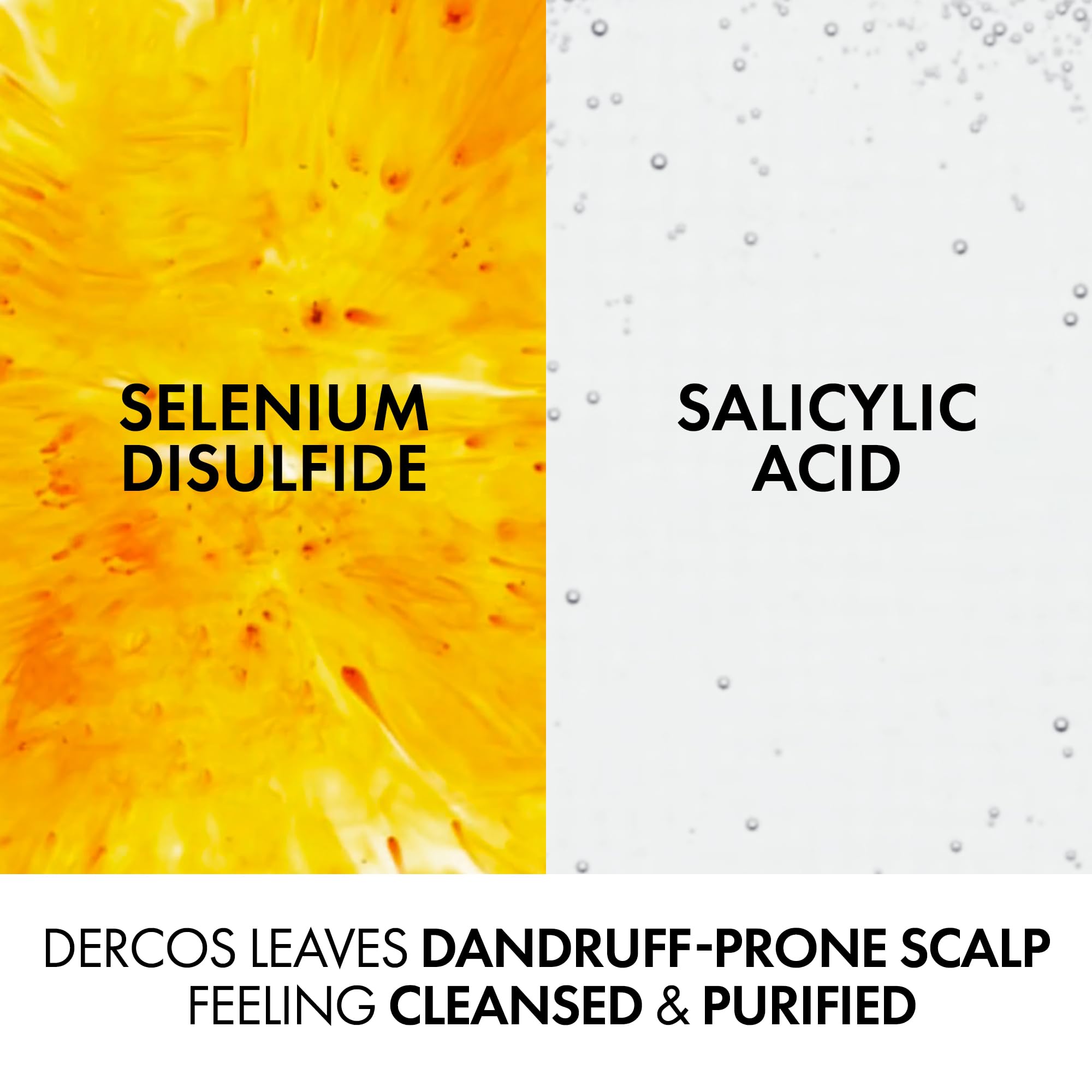 Vichy Dercos Anti-Dandruff Dermatological Shampoo for Dry Hair & Sensitive Scalp, with Salicylic Acid & Selenium Sulfide, 200ml, Soothes Itchiness & Nourishes. - Damaged Box