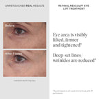 Murad Retinal ReSculpt Eye Lift Treatment - Resurgence Anti-Aging Eye Cream - Firms, Reduces Wrinkles - 0.5 fl oz - New