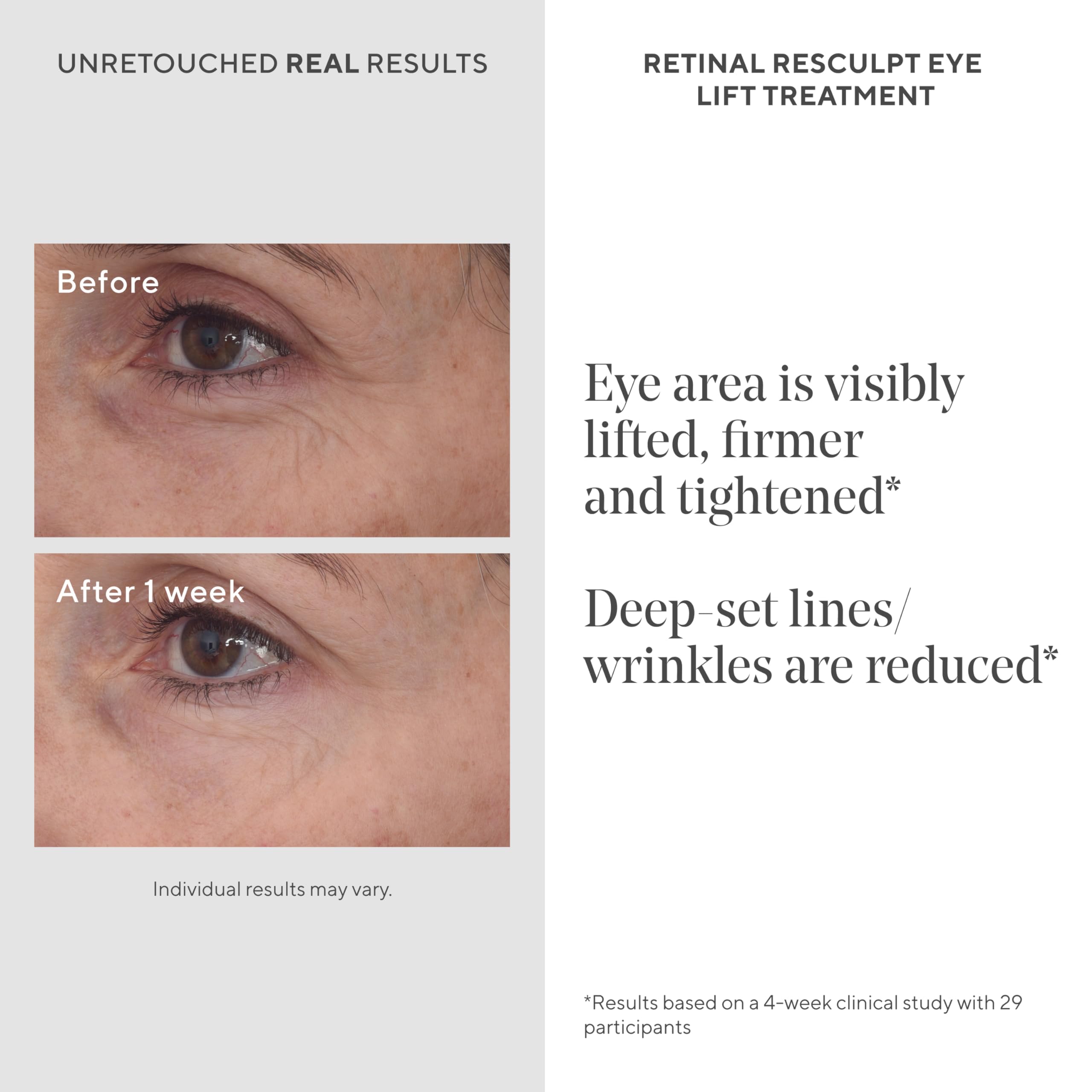Murad Retinal ReSculpt Eye Lift Treatment - Resurgence Anti-Aging Eye Cream - Firms, Reduces Wrinkles - 0.5 fl oz - New