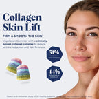 UPSA x Nourished Skin Lift Collagen Gummies - 7-in-1 - Ovoderm Complex, Vitamin C, Multivitamins - 30 Vegetarian Gummies - Damaged Box - BBE 11/2027