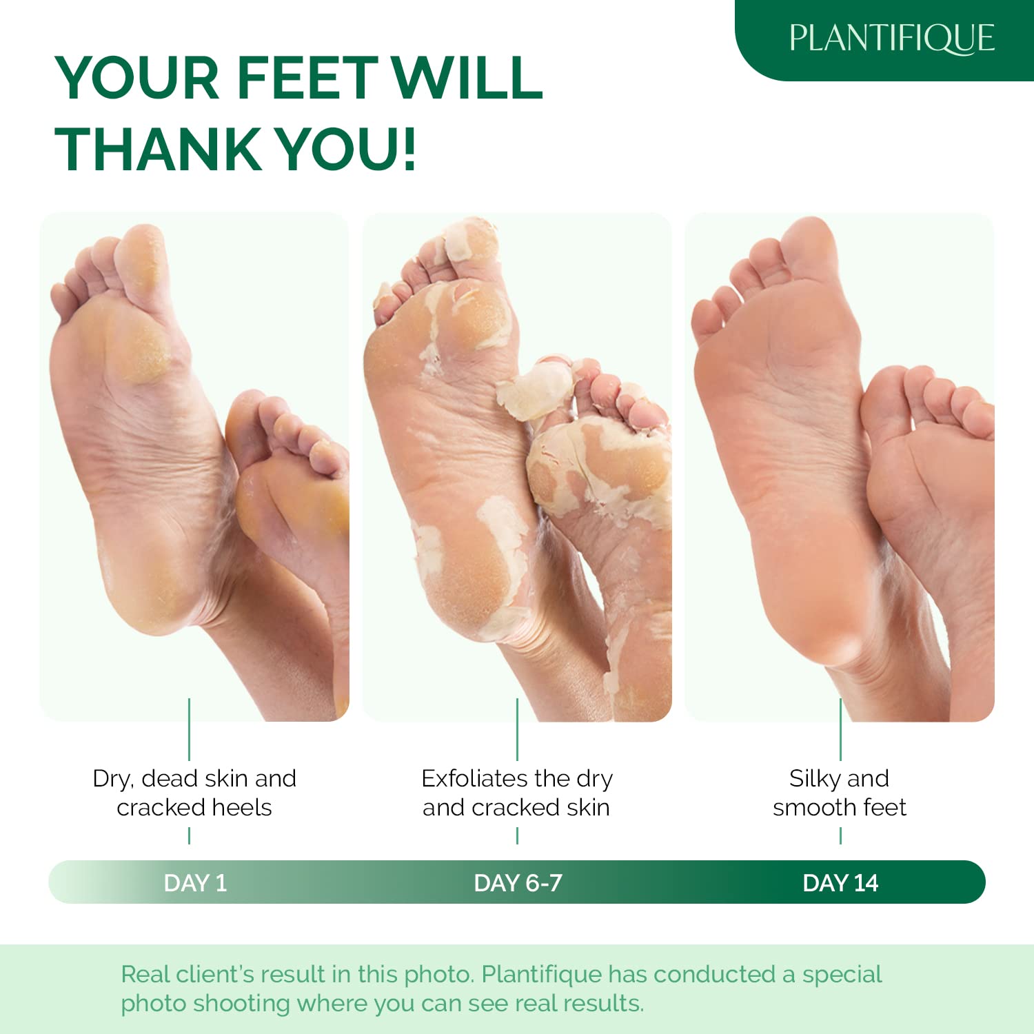PLANTIFIQUE Foot Peel Mask, Dermatologically Tested Foot Treatment, 2 Pairs - New
