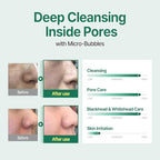 SOME BY MI Bye Bye Blackhead 30 Days Miracle Green Tea Tox Bubble Cleanser - 4.23 Oz, 120g - Made from Green Tea Extract - Mild Daily Face Wash for Removing Sebum and Blackheads - Korean SkinCare - Damaged Box