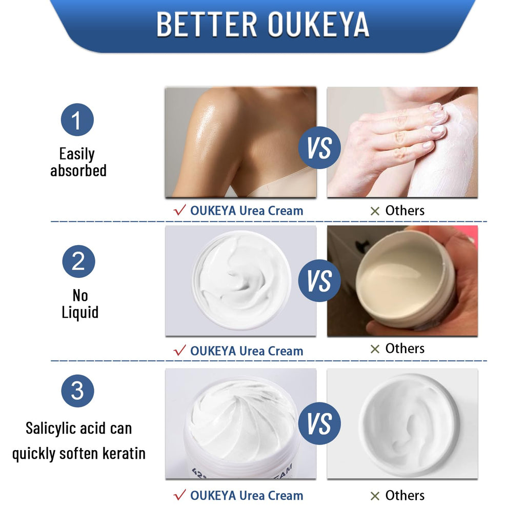 OUKEYA Urea Cream 42% plus Salicylic Acid 2%, Urea Foot Hand Cream for Dry Cracked Feet, Heels, Elbows, Salicylic Acid Cream for Moisturizer, Removes Corns Calluses Dead Skin and Softens Toenails - New - BBE 11/2029