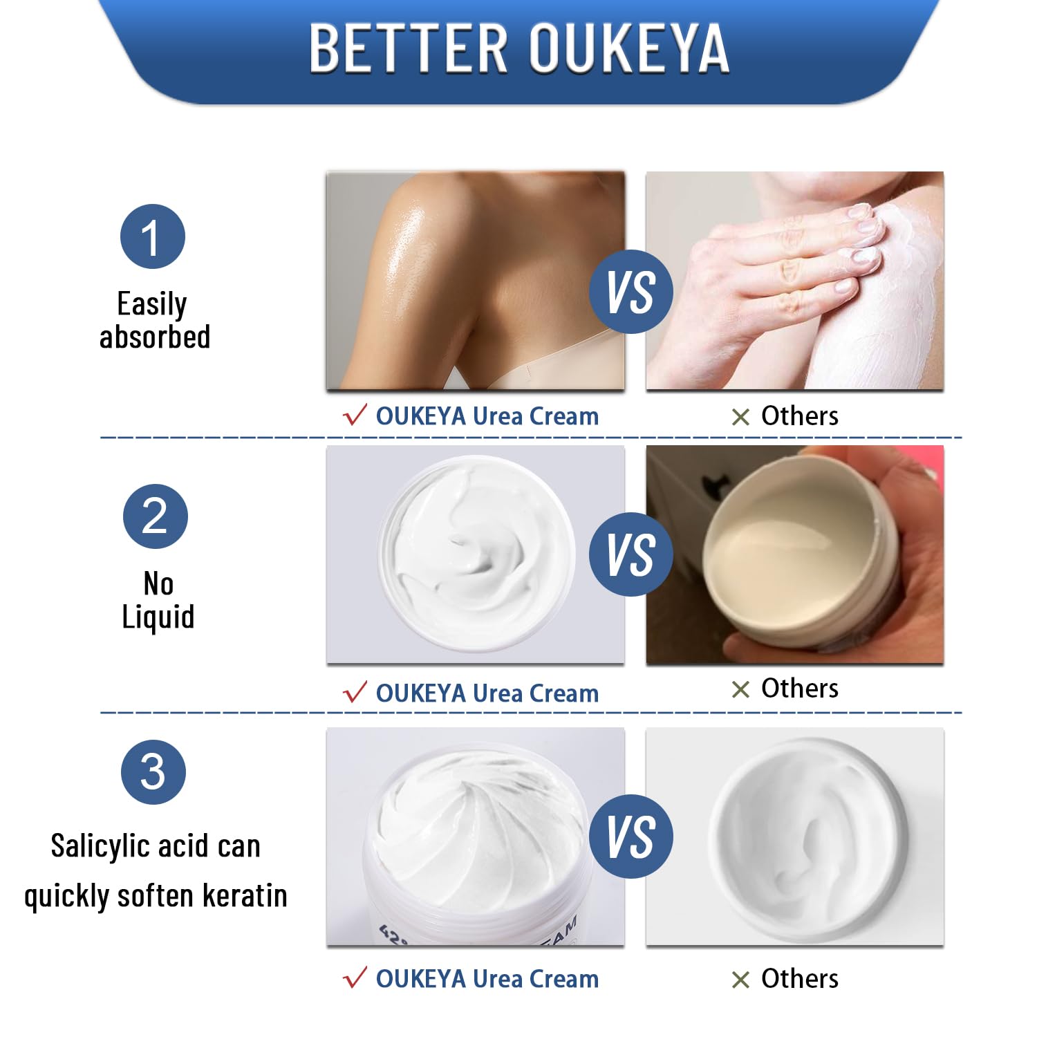 OUKEYA Urea Cream 42% plus Salicylic Acid 2%, Urea Foot Hand Cream for Dry Cracked Feet, Heels, Elbows, Salicylic Acid Cream for Moisturizer, Removes Corns Calluses Dead Skin and Softens Toenails - New - BBE 11/2029