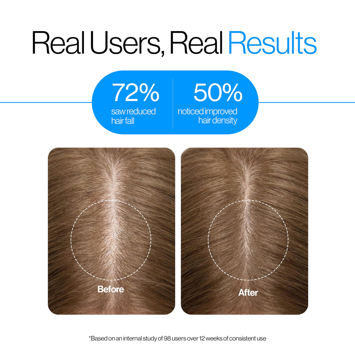 Be Bodywise Rosemary Hair Growth Serum (Roll On) | 3% Redensyl & 2% Anagain | Hair fall control serum for Women & Men | Promotes Hair Growth & Stimulates Hair Follicles | For All Hair Types | 25ml - New