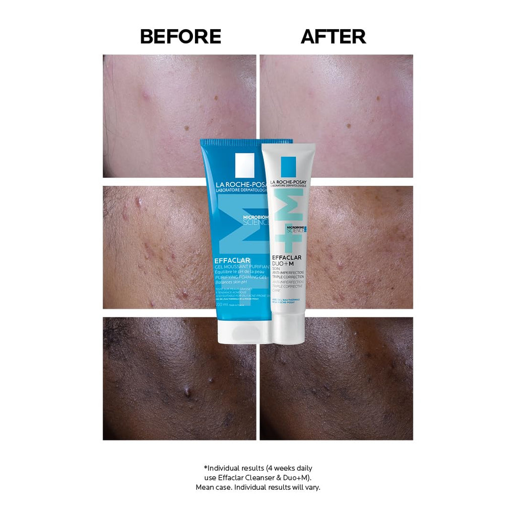 La Roche-Posay Effaclar Duo+M, Anti-Breakout Corrective Gel, 40ml - Damaged Box - BBE 02/2029