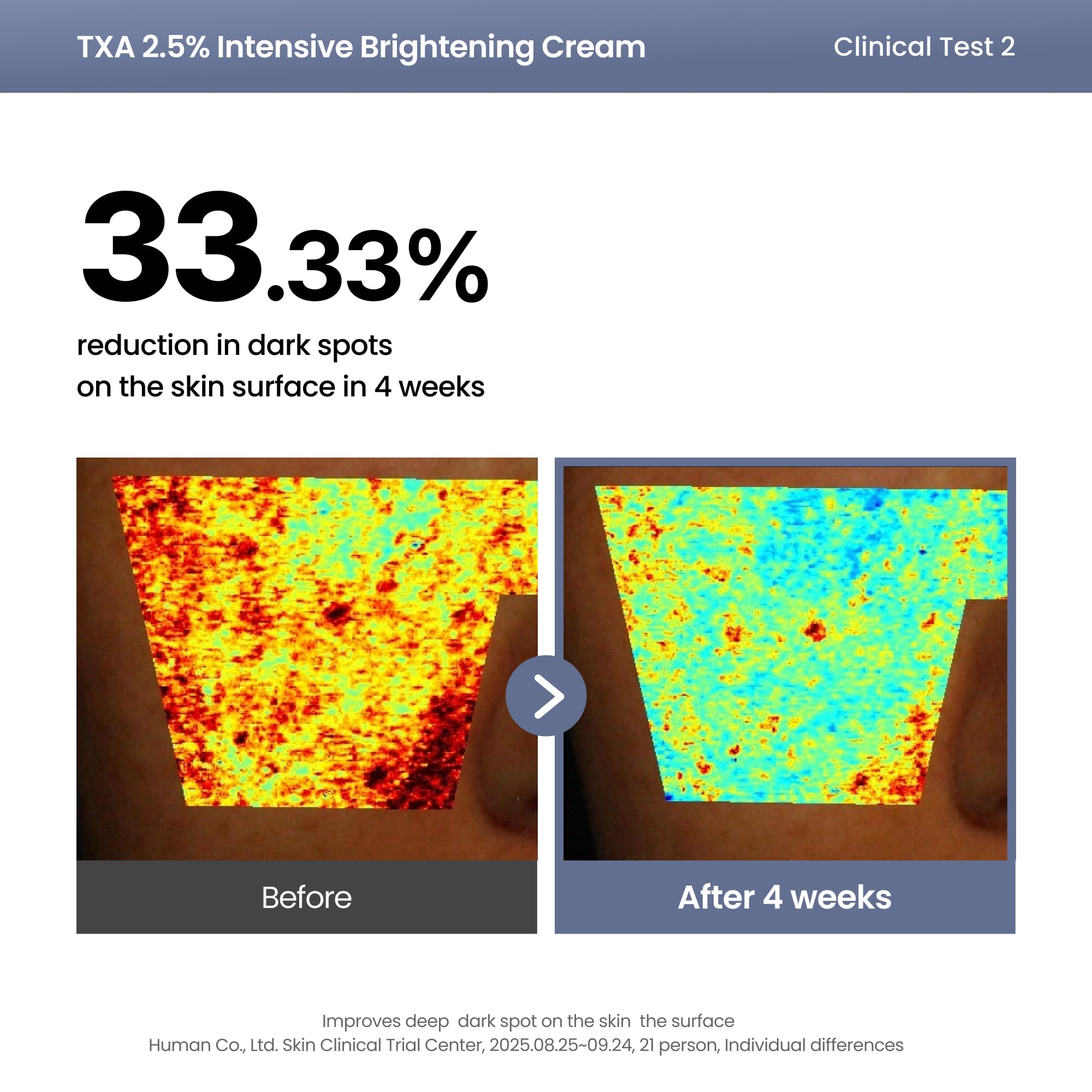 AXIS-Y TXA 2.5% Intensive Brightening Cream - Tranexamic Acid, Niacinamide & Glutathione for Hyperpigmentation & Dark Spot Corrector - Vegan Korean Skin Care Moisturizer Face Cream - 50ml/1.69 fl. oz. - New - BBE 01/2029