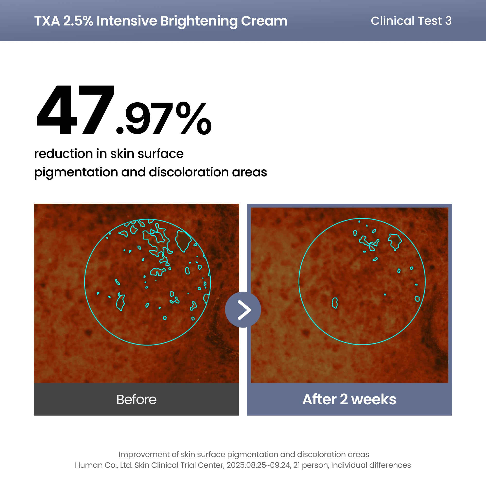AXIS-Y TXA 2.5% Intensive Brightening Cream - Tranexamic Acid, Niacinamide & Glutathione for Hyperpigmentation & Dark Spot Corrector - Vegan Korean Skin Care Moisturizer Face Cream - 50ml/1.69 fl. oz. - New - BBE 01/2029