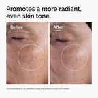 The Ordinary Glycolic Acid 7% Exfoliating Toner, Brightening and Smoothing Daily Toner for More Even-Looking Skin Tone, 240ml - New