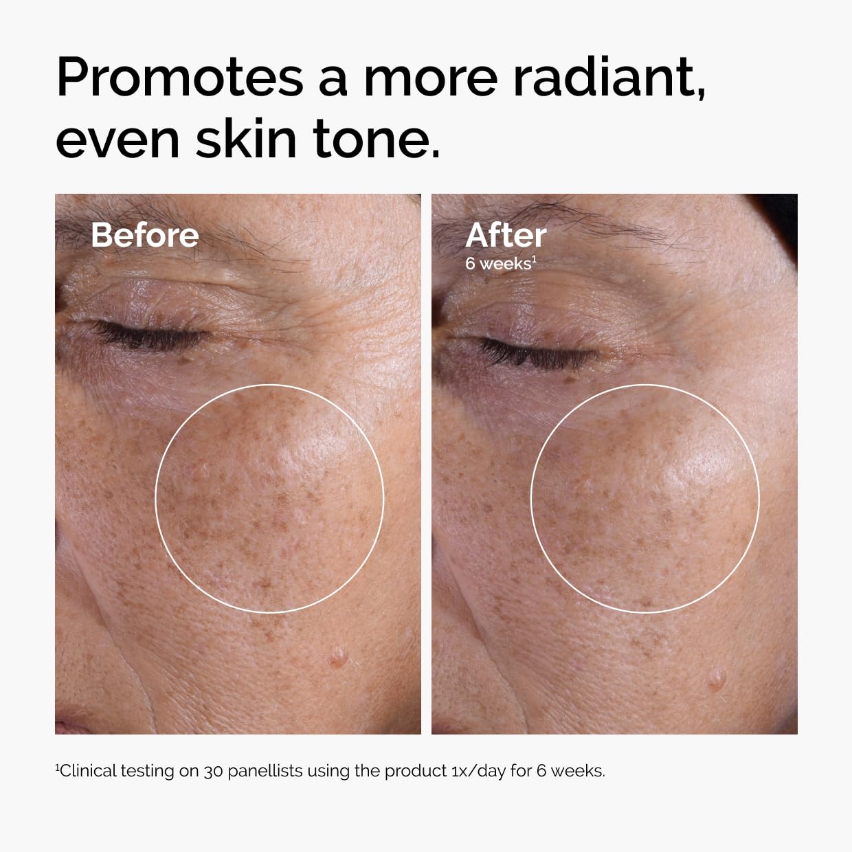 The Ordinary Glycolic Acid 7% Exfoliating Toner, Brightening and Smoothing Daily Toner for More Even-Looking Skin Tone, 240ml - New