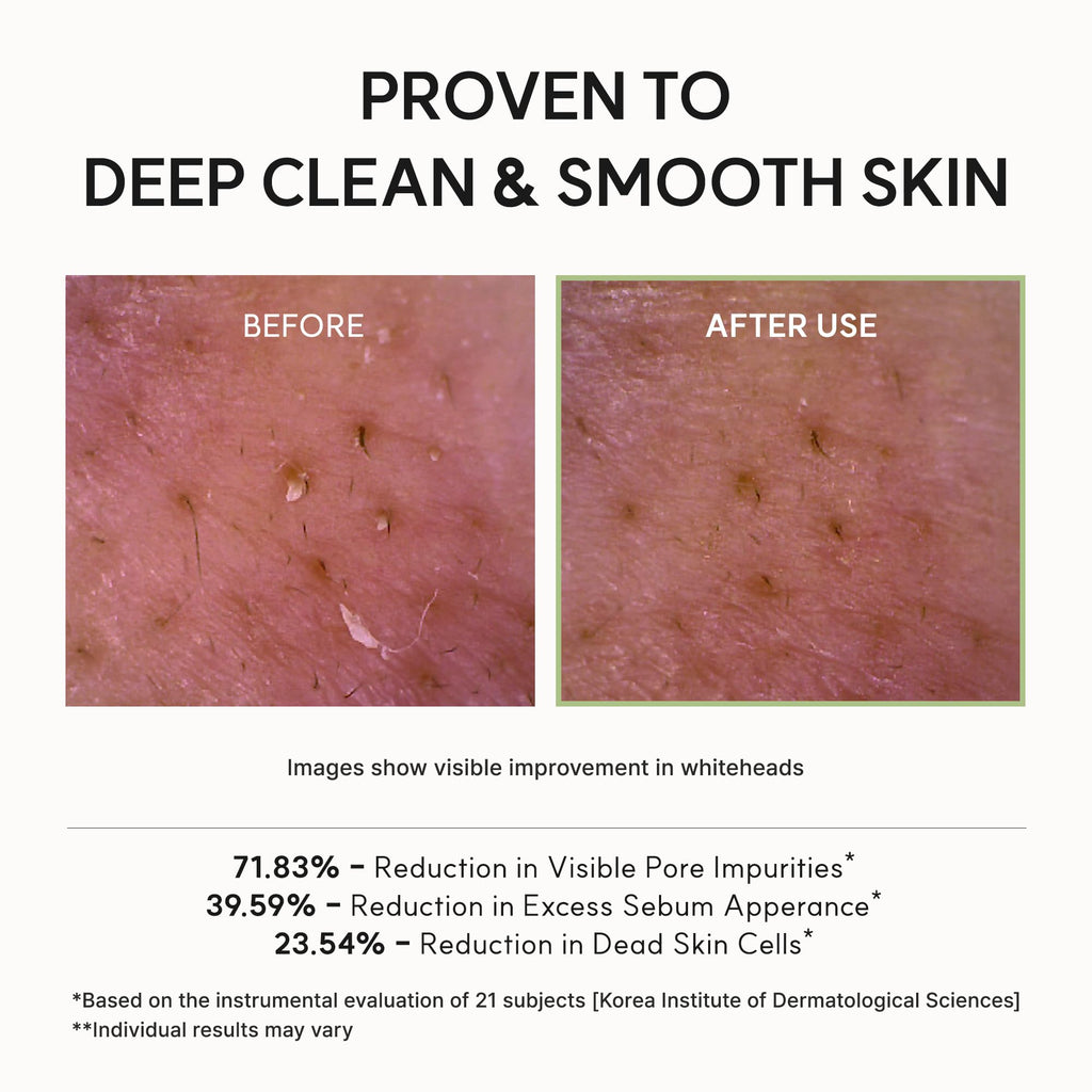Arencia Korean Rice Mochi Face Cleanser - Face Mask, Foaming Cleanser, Gentle Scrub All in One - Deep Cleansing, Moisturizing, Pore Minimizing, Removing Blackhead- with Rice Water & Green Tea, Mugwort - New - BBE 03/2029
