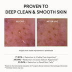Arencia Korean Rice Mochi Face Cleanser - Face Mask, Foaming Cleanser, Gentle Scrub All in One - Deep Cleansing, Moisturizing, Pore Minimizing, Removing Blackhead- with Rice Water & Green Tea, Mugwort - New - BBE 03/2029