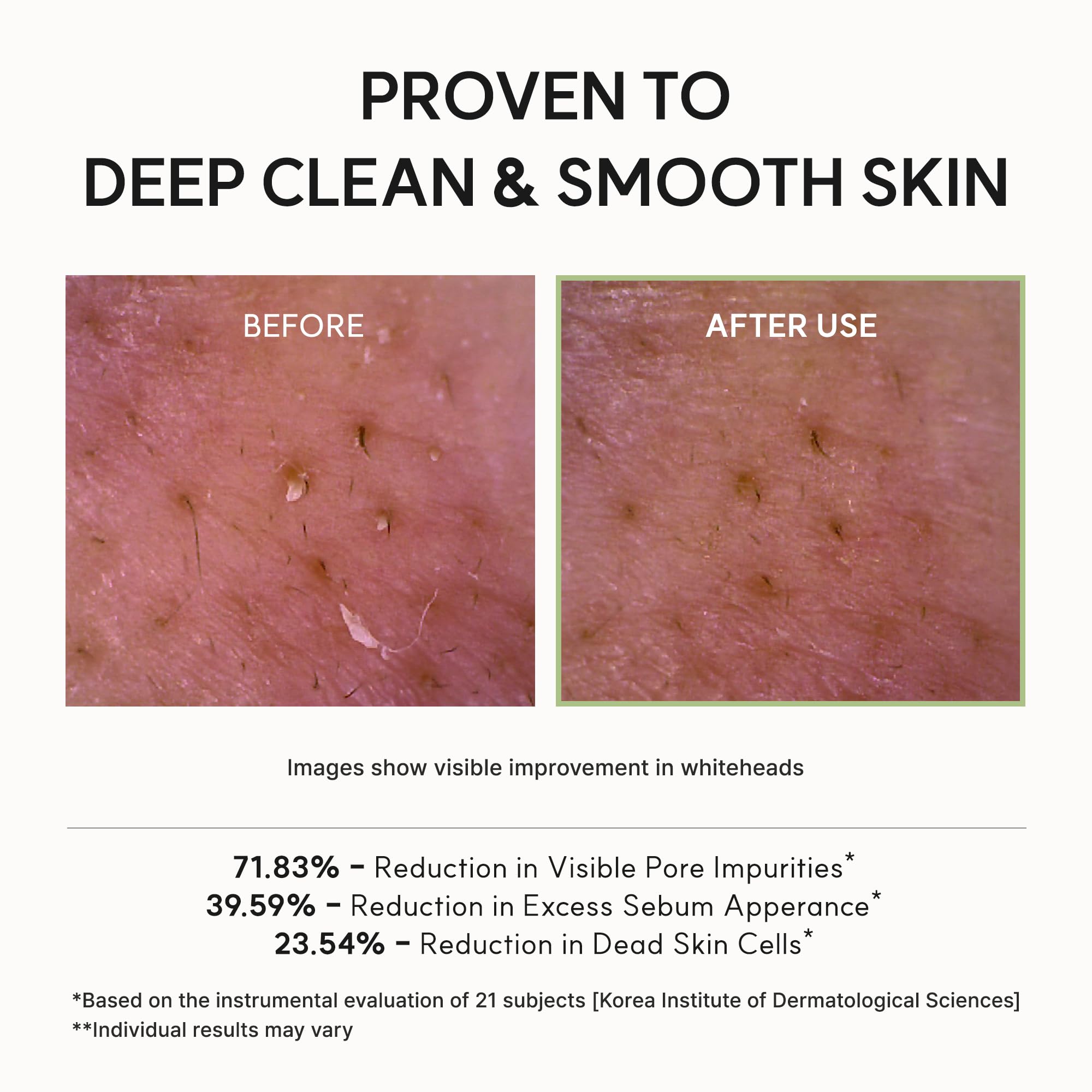 Arencia Korean Rice Mochi Face Cleanser - Face Mask, Foaming Cleanser, Gentle Scrub All in One - Deep Cleansing, Moisturizing, Pore Minimizing, Removing Blackhead- with Rice Water & Green Tea, Mugwort - New - BBE 03/2029
