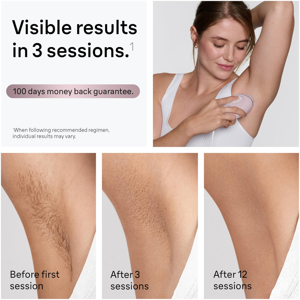 Braun Silk-Expert Mini PL1112 IPL Hair Removal Device - At Home Permanent Hair Reduction for Women, Face & Body - Damaged Box