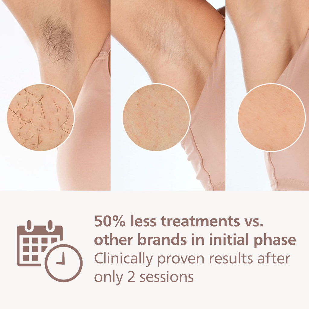 Philips Lumea 7000 Series IPL Hair Removal Device BRI921/00 - Laser Alternative, Body & Face, Satin Compact Trimmer - Damaged Box