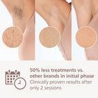 Philips Lumea 7000 Series IPL Hair Removal Device BRI921/00 - Laser Alternative, Body & Face, Satin Compact Trimmer - Damaged Box
