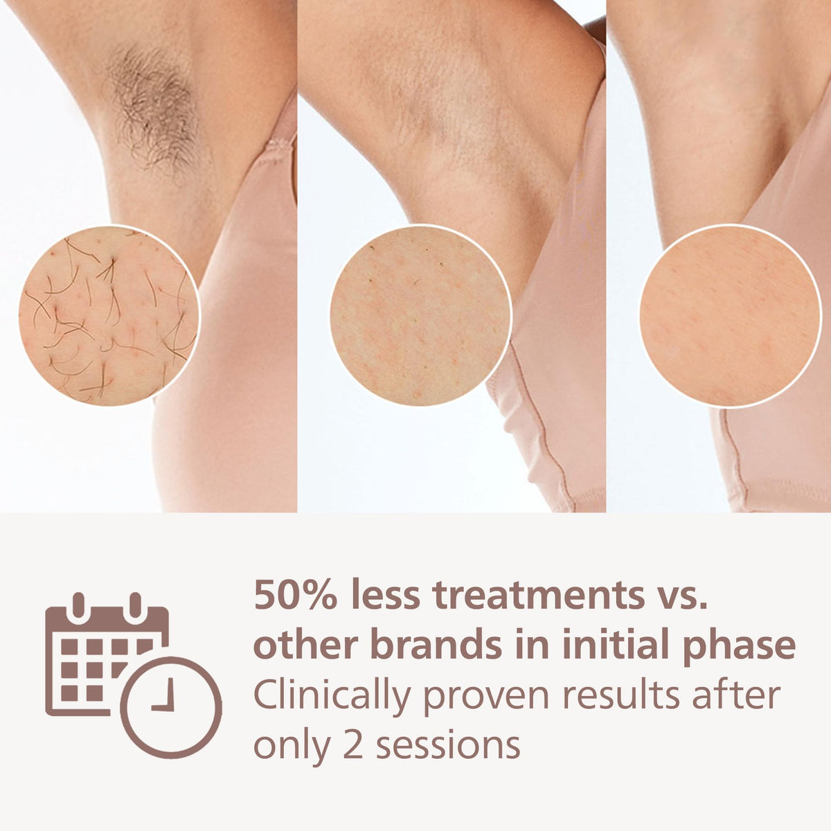Philips Lumea 7000 Series IPL Hair Removal Device BRI921/00 - Laser Alternative, Body & Face, Satin Compact Trimmer - Damaged Box