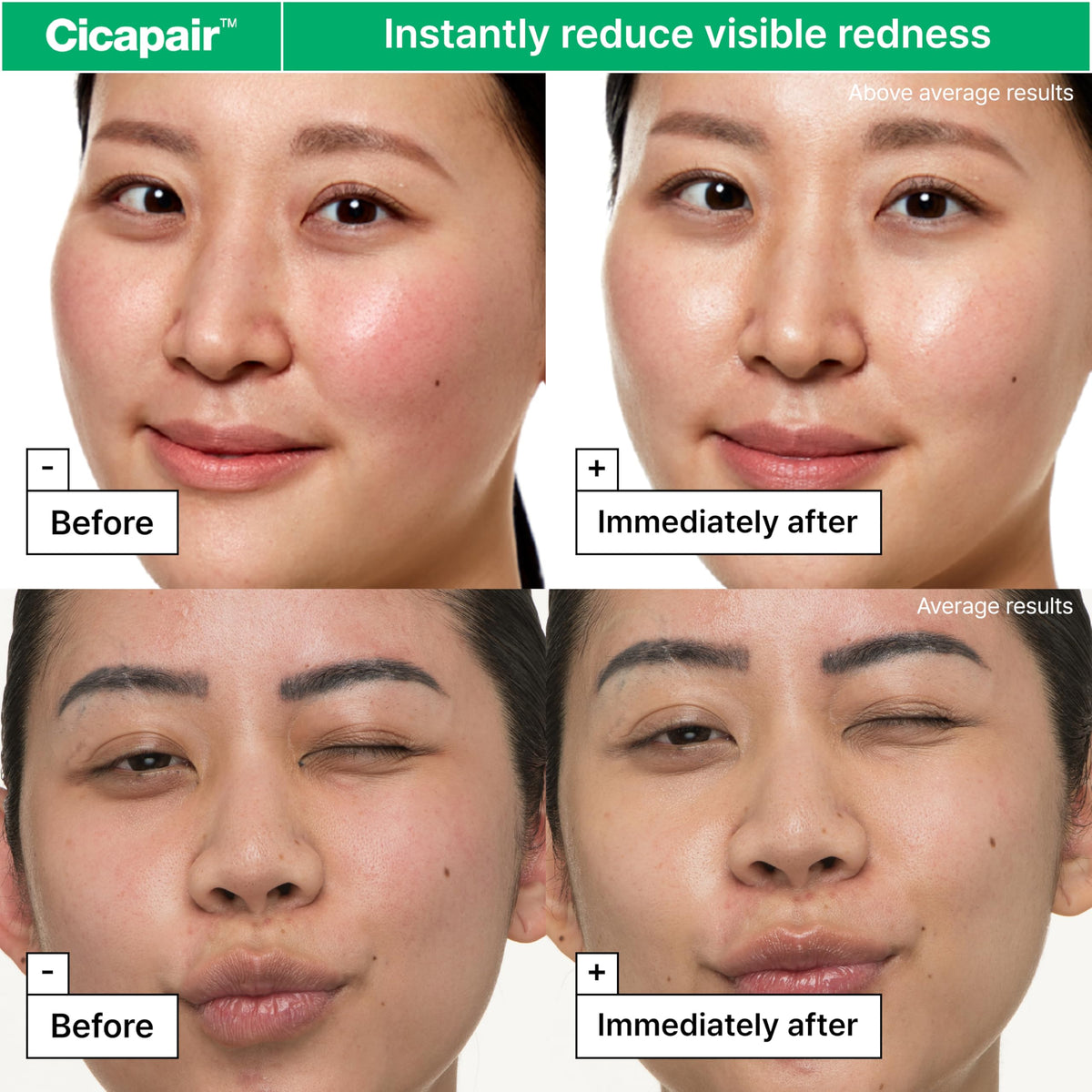 Dr.Jart+ Cicapair Sensitive Skin Face Moisturiser - Redness & Barrier Repair Cream with Centella Asiatica - Korean Skincare 50ml - New