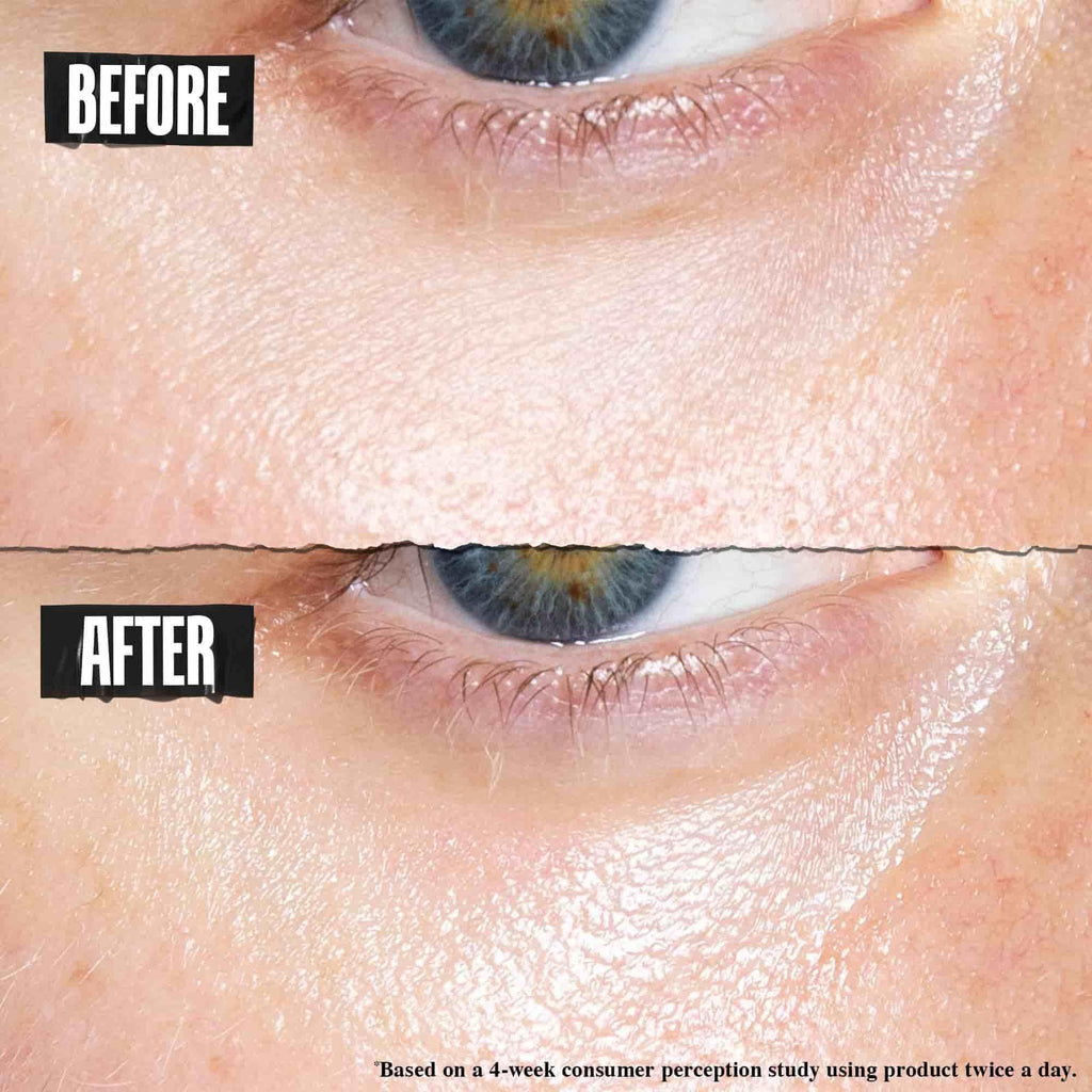 Kiehl's Creamy Eye Treatment with Avocado - Rich Under Eye Cream 28ml - Hydrating Moisturiser - New