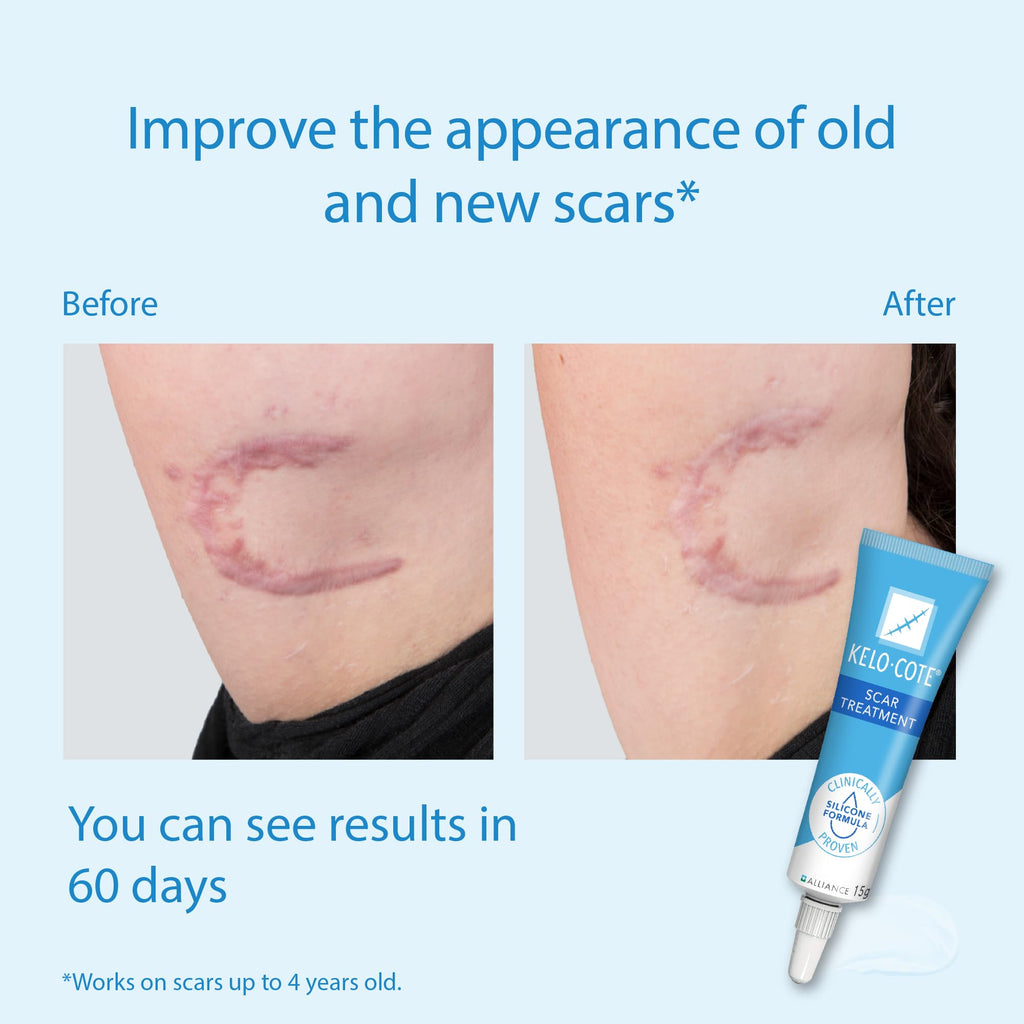 Kelo-Cote Gel Silicone Scar Treatment Advanced Formula - 6g - Scar Reduction & Management - Like New - BBE 09/2029