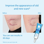 Kelo-Cote Gel Silicone Scar Treatment Advanced Formula - 6g - Scar Reduction & Management - Like New - BBE 09/2029