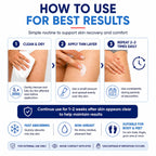Terthon Antifungal Cream - Ringworm & Jock Itch Treatment - Fast-Acting Plant-Based Skin Care - Groin, Body, Feet - 100g - Damaged Box - BBE 05/2028