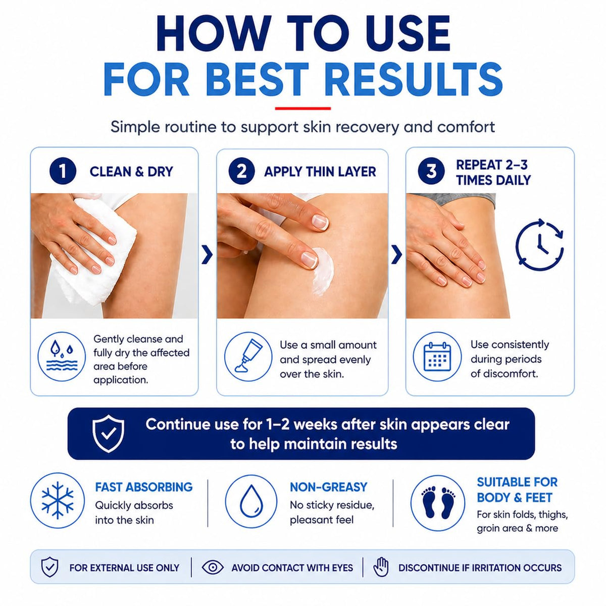 Terthon Antifungal Cream - Ringworm & Jock Itch Treatment - Fast-Acting Plant-Based Skin Care - Groin, Body, Feet - 100g - Damaged Box - BBE 05/2028