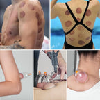 Ditind Cupping Therapy Set - 18 Pcs Vacuum Suction Cups - Acupoint Cellulite Muscle Pain Relief - Portable Case Pump - Damaged Box