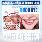 Teeth Whitening Kit with LED Light - 5 Gels - Wireless, Water-Resistant - Gentle for Sensitive Teeth - Home Use Stain Remover - Like New - BBE 03/2029