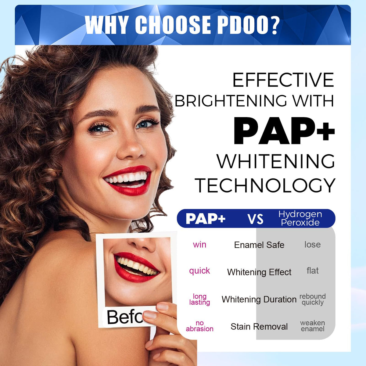 Teeth Whitening Kit with LED Light - 5 Gels - Wireless, Water-Resistant - Gentle for Sensitive Teeth - Home Use Stain Remover - Like New - BBE 03/2029