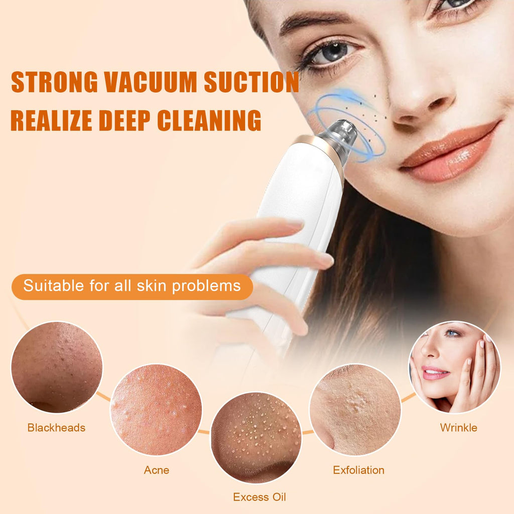 IGEAIIE Blackhead Remover Vacuum - Pore Cleaner Tool - 5 Suction Heads - 3 Modes - Deep Cleansing Device - Damaged Box