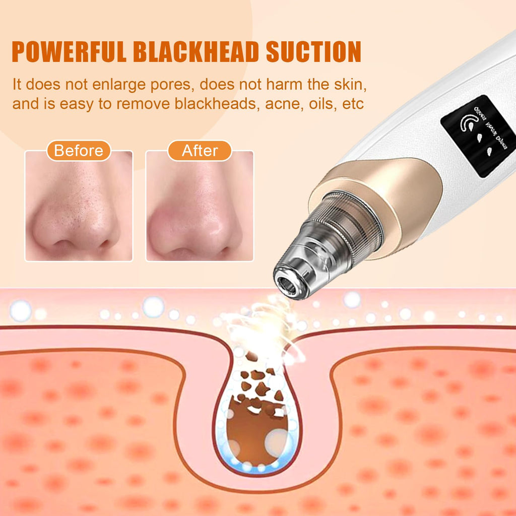 IGEAIIE Blackhead Remover Vacuum - Pore Cleaner Tool - 5 Suction Heads - 3 Modes - Deep Cleansing Device - Damaged Box