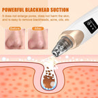 IGEAIIE Blackhead Remover Vacuum - Pore Cleaner Tool - 5 Suction Heads - 3 Modes - Deep Cleansing Device - Damaged Box