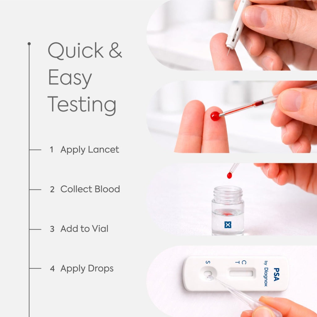 Diagnox PSA Test Kit for Men - Prostate Screening Blood Test - 1 Test Kit Home Health Check - Damaged Box - BBE 09/2028