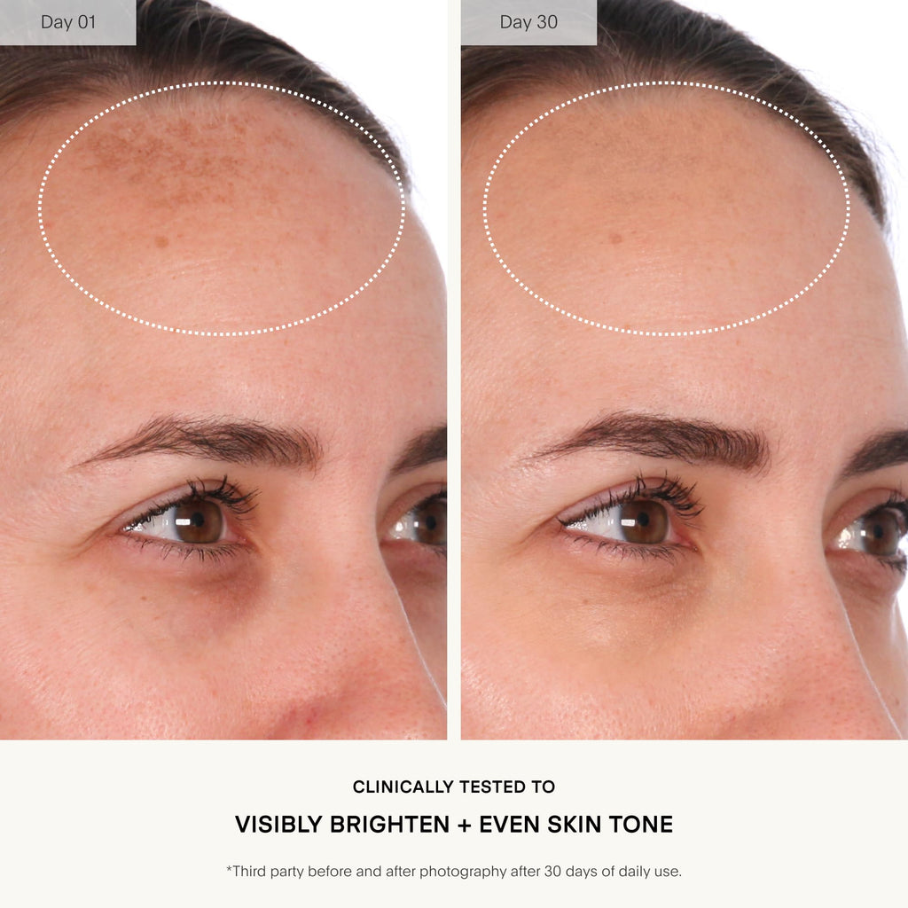 U Beauty Resurfacing Compound Serum - 15ml - Vitamin C Retinol Hyaluronic Acid Peptides - Face Fine Lines Pores - New