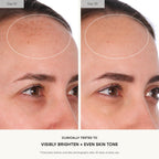 U Beauty Resurfacing Compound Serum - 15ml - Vitamin C Retinol Hyaluronic Acid Peptides - Face Fine Lines Pores - New