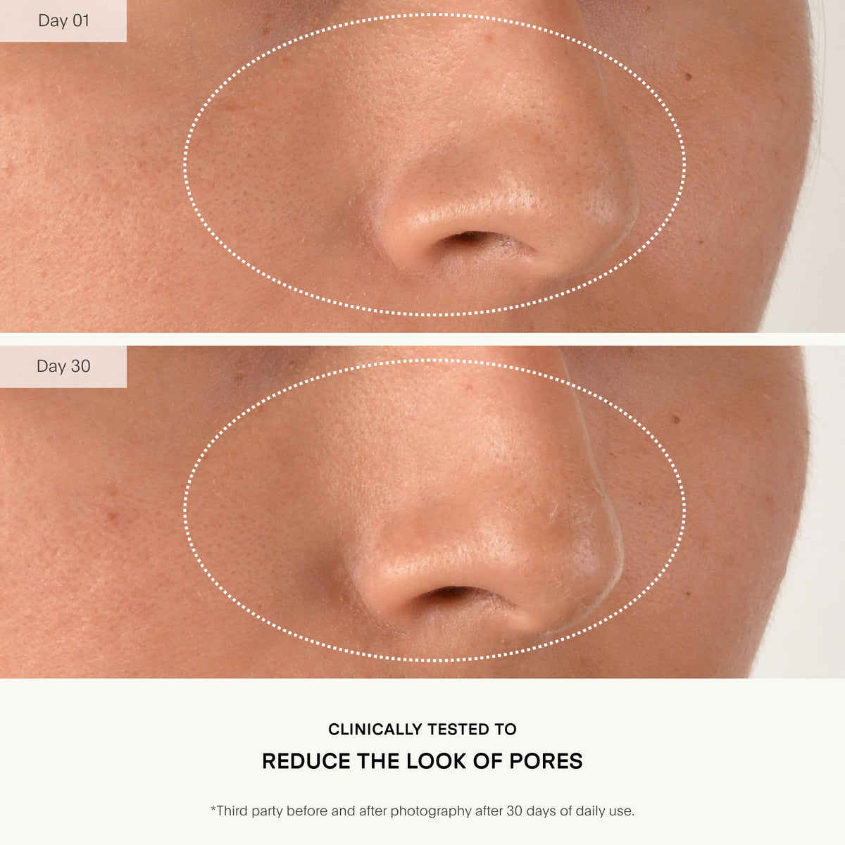 U Beauty Resurfacing Compound Serum - 15ml - Vitamin C Retinol Hyaluronic Acid Peptides - Face Fine Lines Pores - New