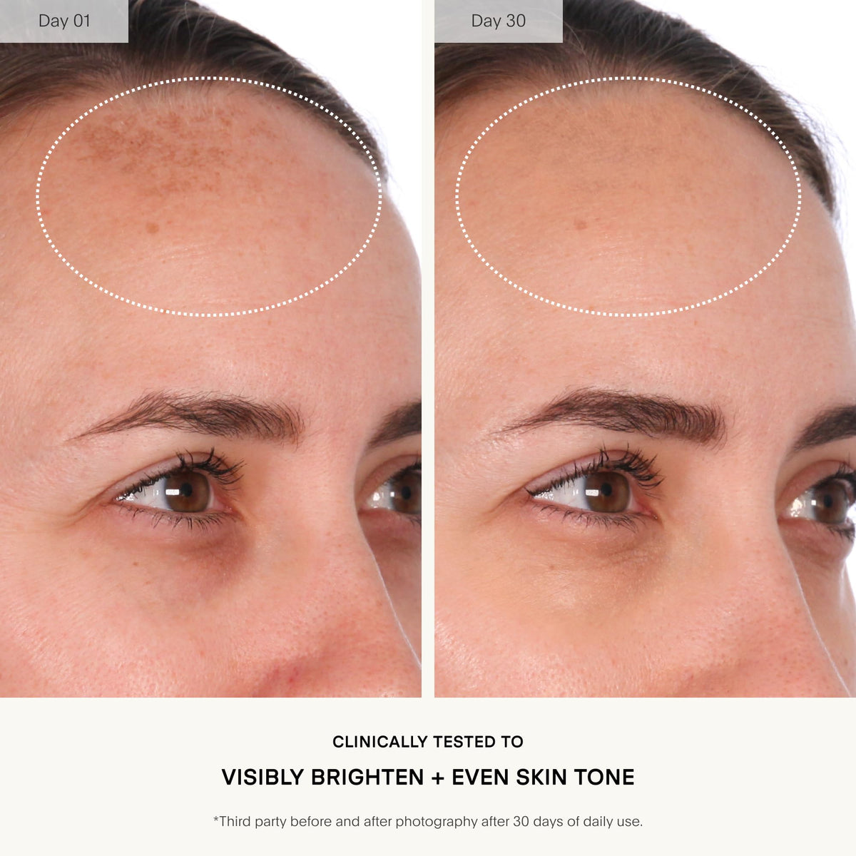 U Beauty Resurfacing Compound Serum - 1.0 fl.oz - Vitamin C Retinol Hyaluronic Acid Peptides - Face Fine Lines Pores - New