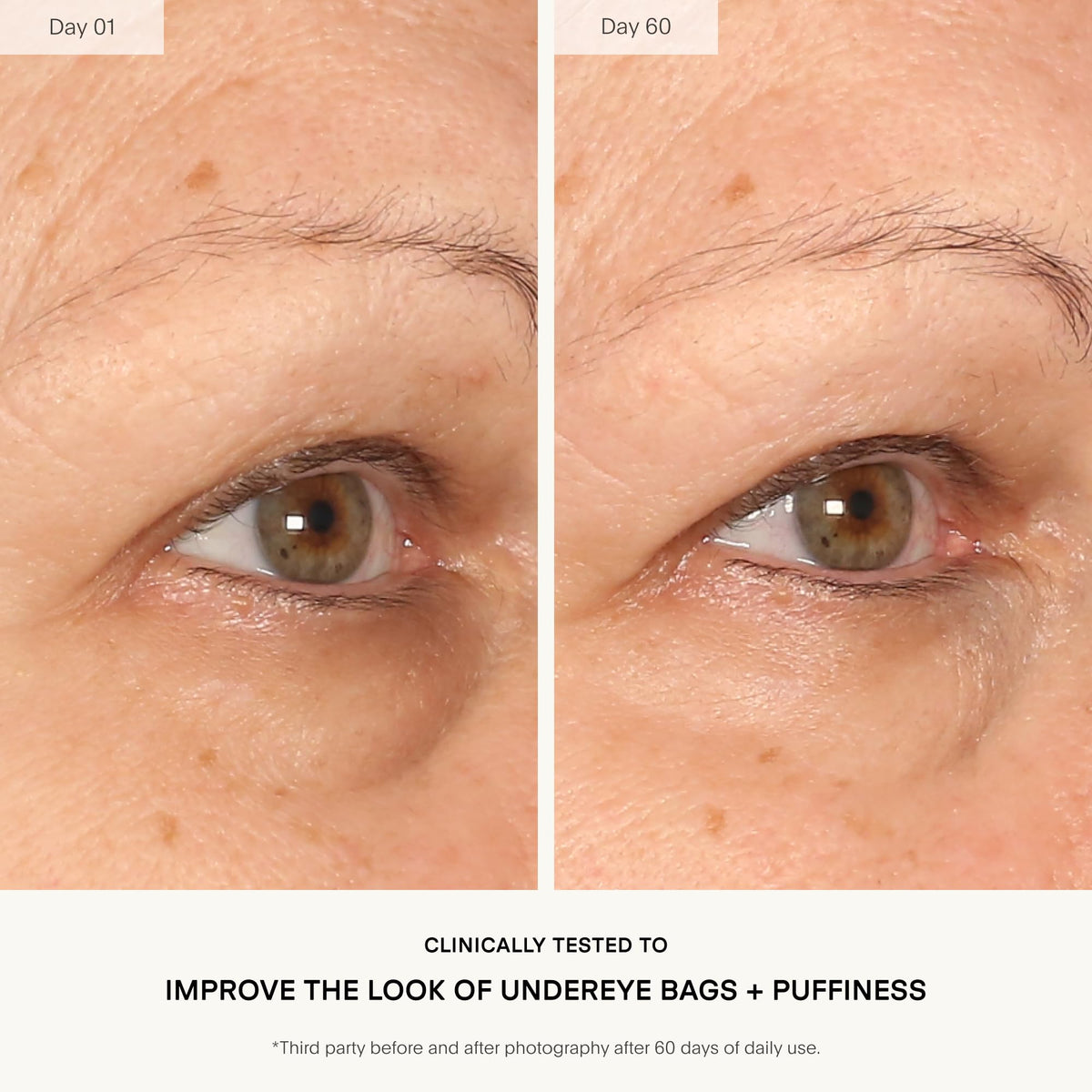 U Beauty The RETURN Eye Concentrate - Anti-Aging Eye Cream - Peptides, Antioxidants - Reduces Fine Lines, Puffiness, Dark Circles - 15ml - New