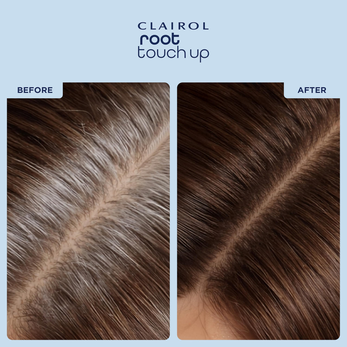 Clairol Root Touch-Up Concealing Powder - Medium Brown - 1 Count Hair Colour Concealer - Damaged Box