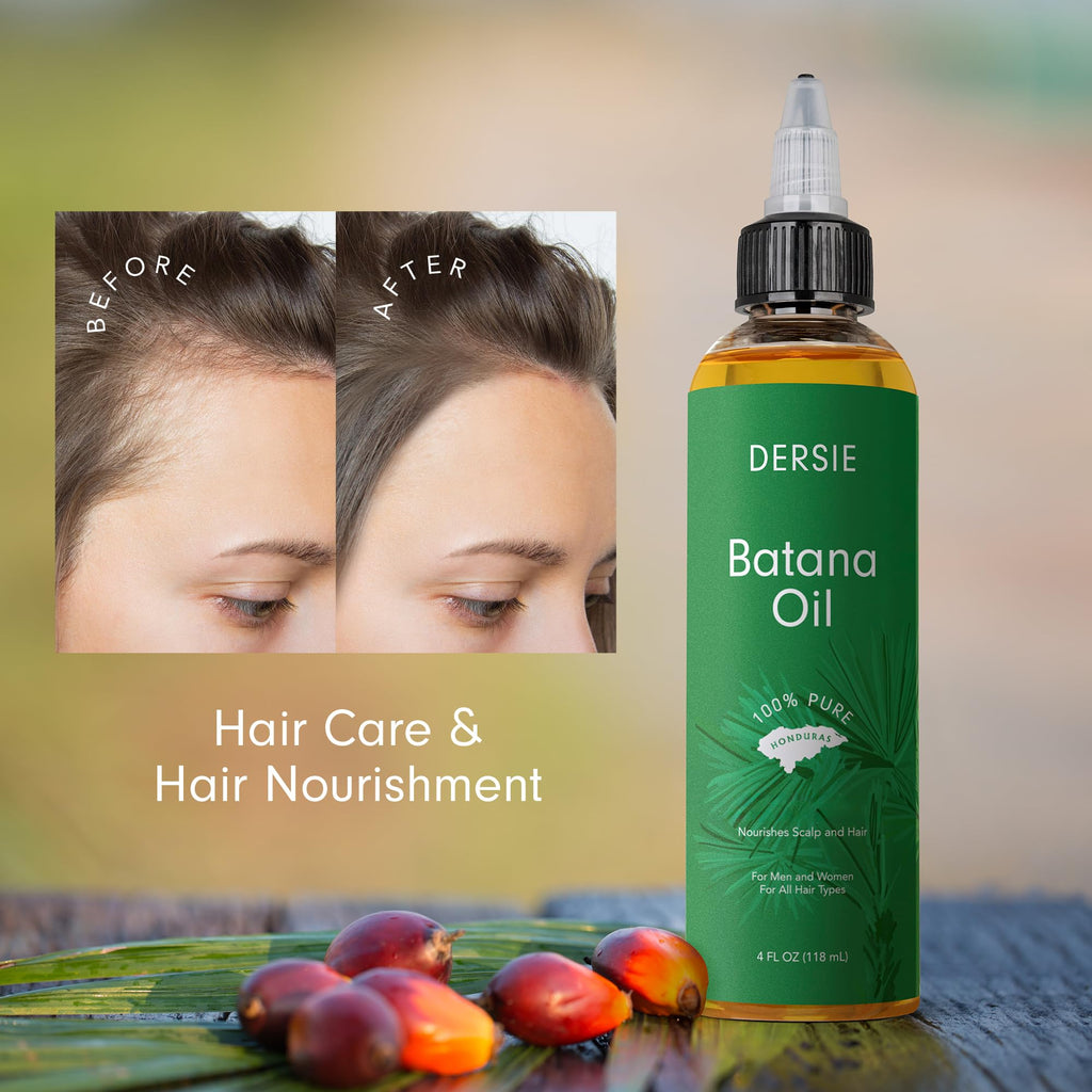 Dersie Batana Oil - 100% Pure Raw Honduras Hair Growth Oil for Thicker Stronger Hair - 4 fl oz Dr Sebi Inspired - New