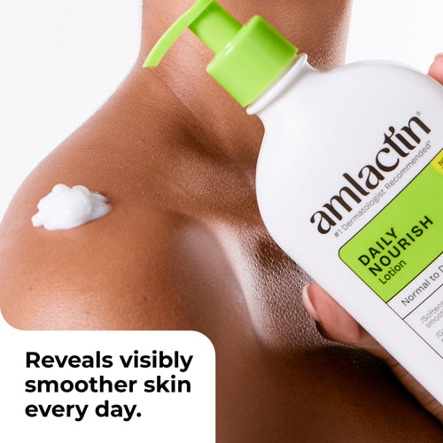 AmLactin Daily Moisturizing Body Lotion - Alpha-Hydroxy Therapy, Exfoliates, Smooths Dry Skin - Paraben-Free 7.9 oz - Damaged Box