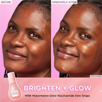 Glow Recipe Watermelon Glow Niacinamide Dew Drops Serum - Hydrating Face Primer & Liquid Highlighter with Hyaluronic Acid - 40ml - Damaged Box