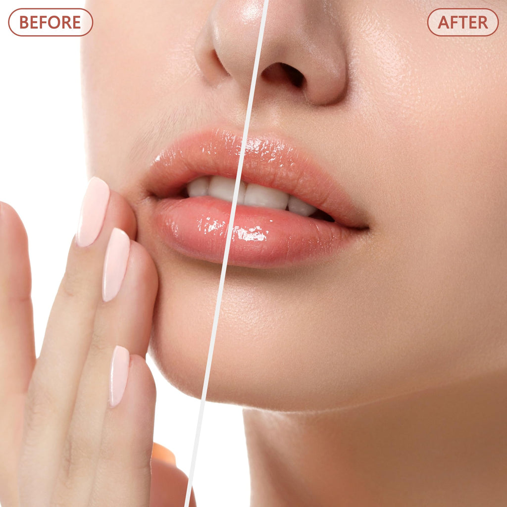 Electric Facial Hair Remover for Women - Painless Face Shaver Peach Fuzz Lips - Rose Gold Portable Hair Removal Device with Light - Damaged Box