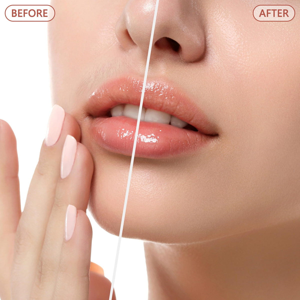 Electric Facial Hair Remover for Women - Painless Face Shaver Peach Fuzz Lips - Rose Gold Portable Hair Removal Device with Light - Damaged Box