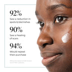47 Skin Anti-Blemish & Scar Repair Serum - Face Treatment for Acne Spots Redness Uneven Skin Tone - 50ml - Damaged Box