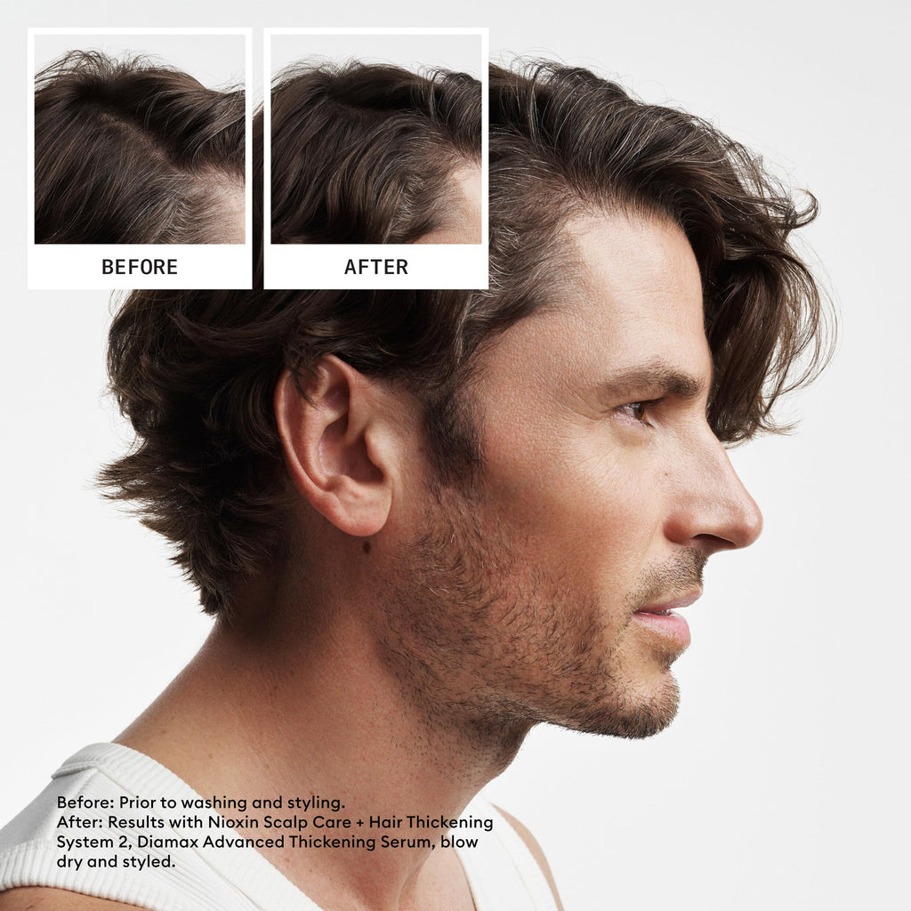 Nioxin System 2 Scalp & Hair Thickening Kit - Shampoo, Conditioner, Treatment - Natural Hair, Progressed Thinning 150+150+40ml - Damaged Box